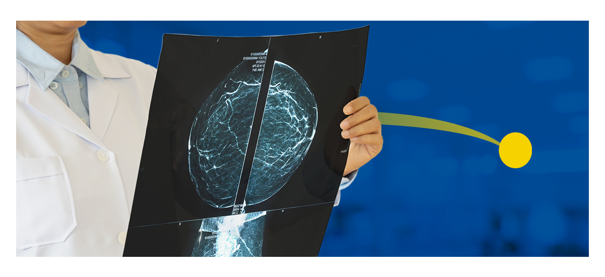 A radiologist looks at a scan