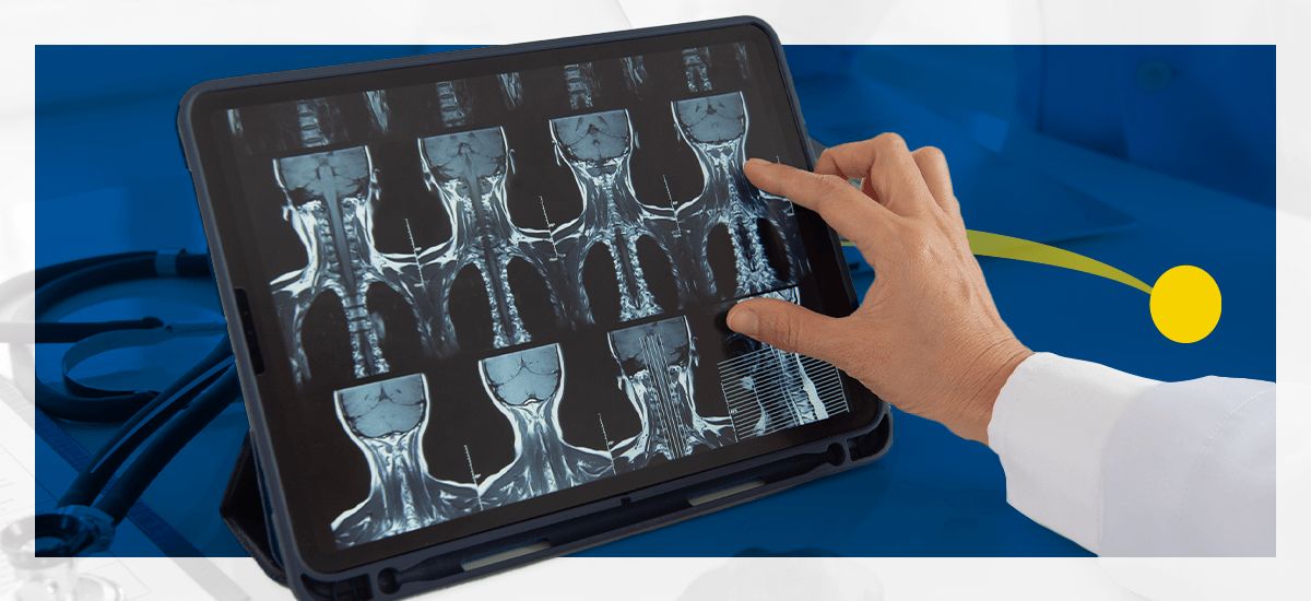 A man looks at radiology images on a tablet