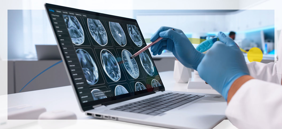 A radiologist views brain scans on a laptop while scrolling with a stylus